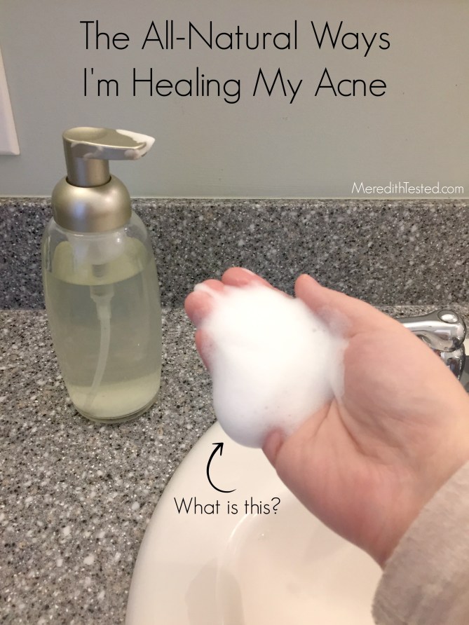 All natural, organic ways I'm healing my random flare up of adult acne -- MeredithTested.com